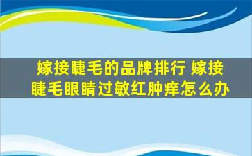 嫁接睫毛的品牌排行 嫁接睫毛眼睛过敏红肿痒怎么办